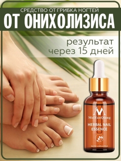 Отзыв на от грибка, от онихолизис, для кутикулы