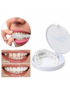 Отзыв на Виниры для эстетического протезирования зубов Snap On Smile